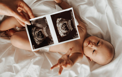 Baby and ultrasound photos.